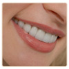 Veneers